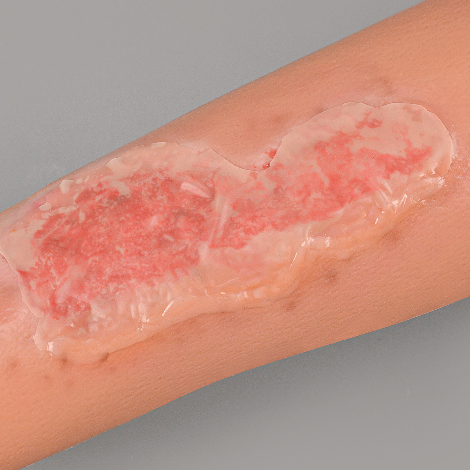 Abrasion Wound Care Simulation Sleeve