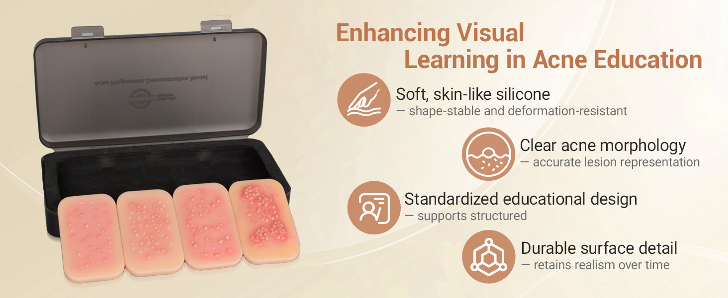 Acne Progression Teaching Model (Grades I–IV)