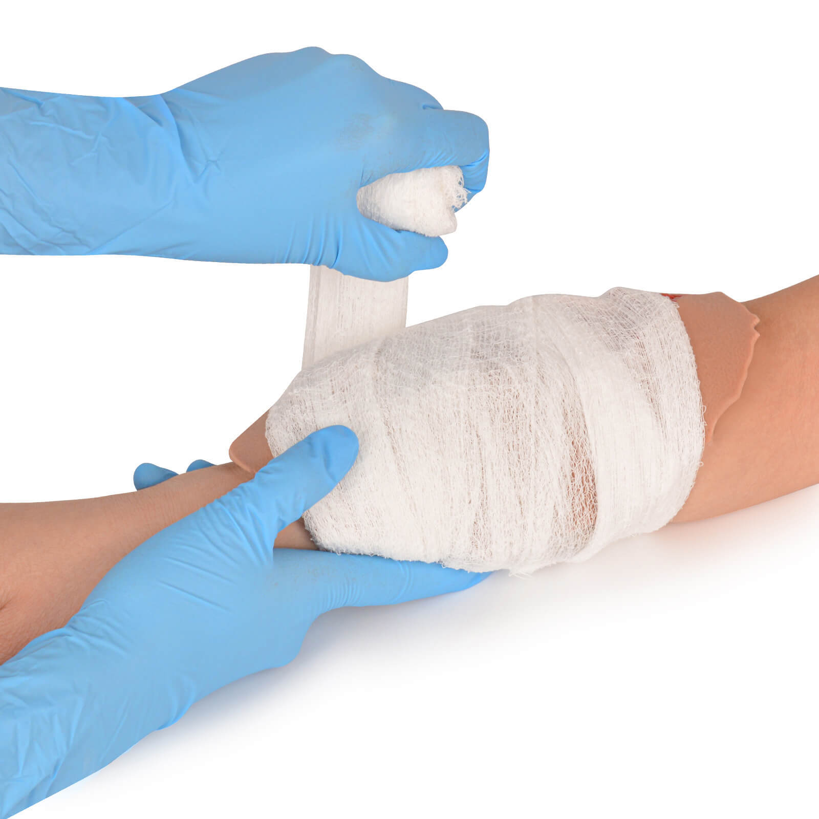 Adhesive Open Fracture Wound Moulage for Wound Care Practice