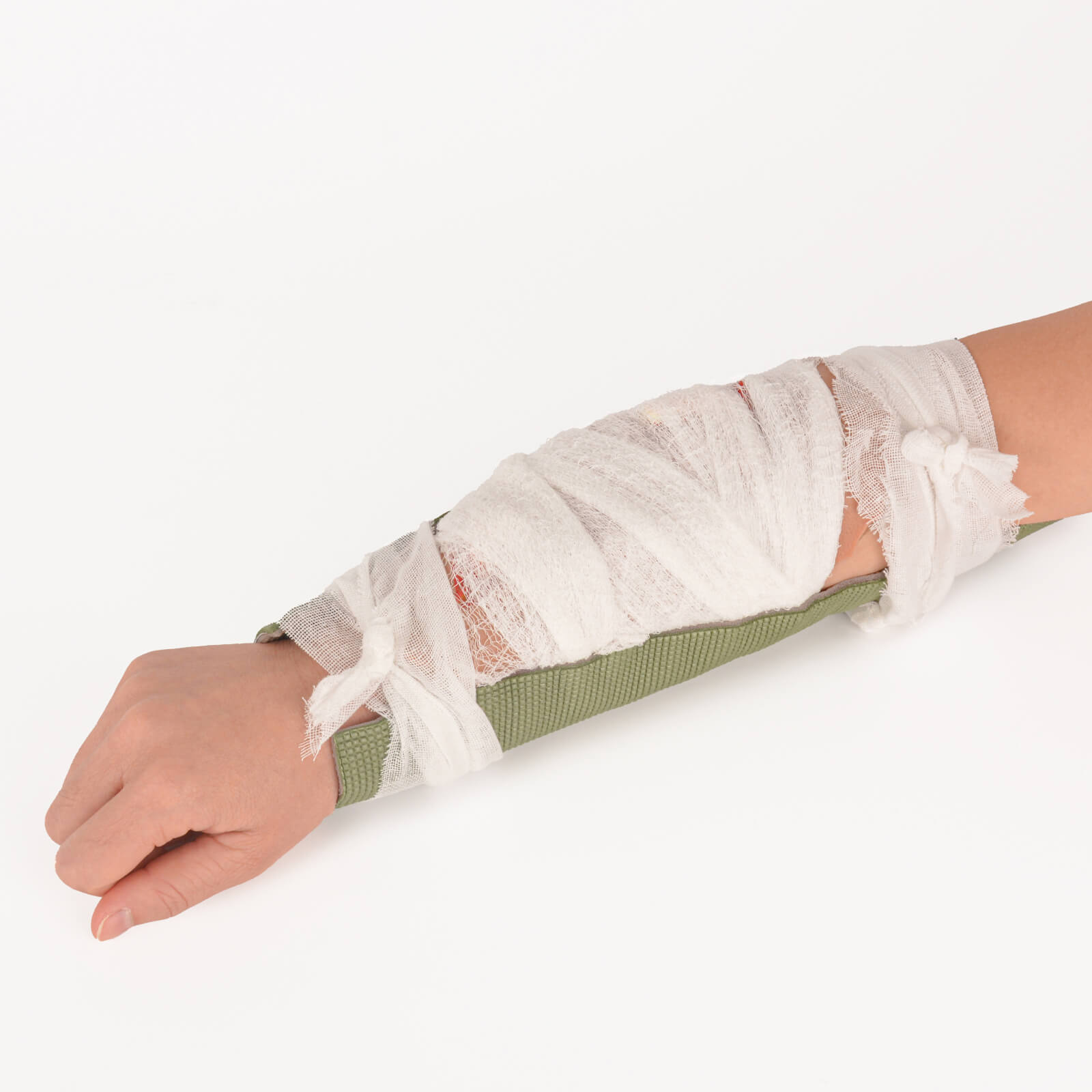 Adhesive Open Fracture Wound Moulage for Fracture Stabilization Simulation