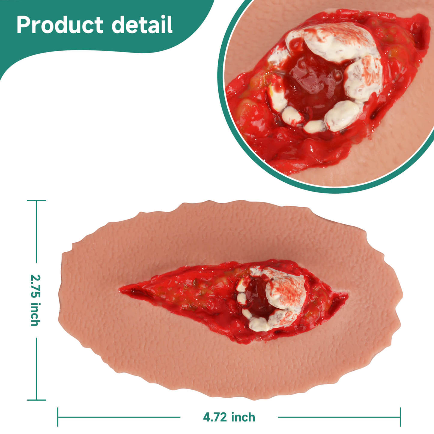 Adhesive Open Fracture Wound Moulage Grade 2 Size