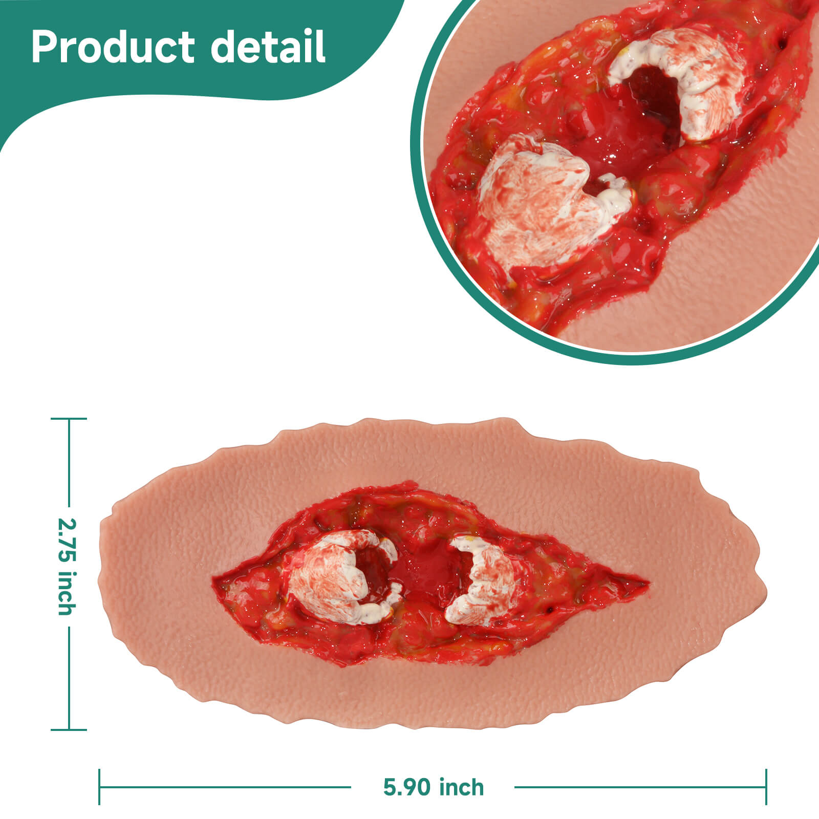 Adhesive Open Fracture Wound Moulage Grade 3 Size
