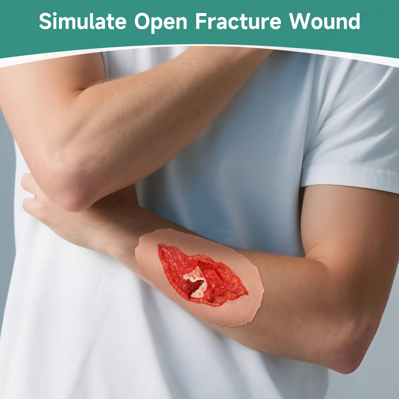 Adhensive Open Fracture Wound Moulage