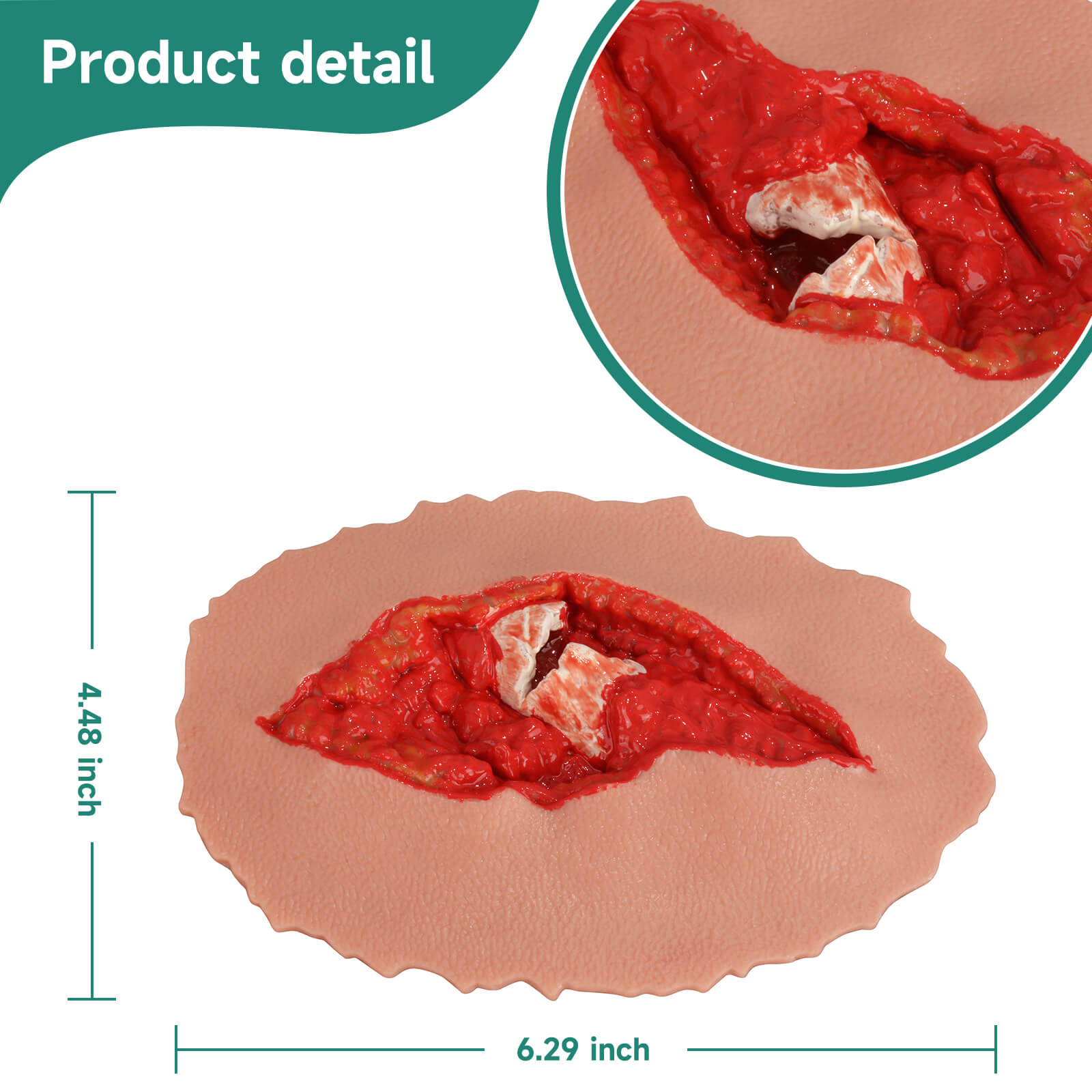 Adhesive Open Fracture Wound Moulage Grade 4 Size