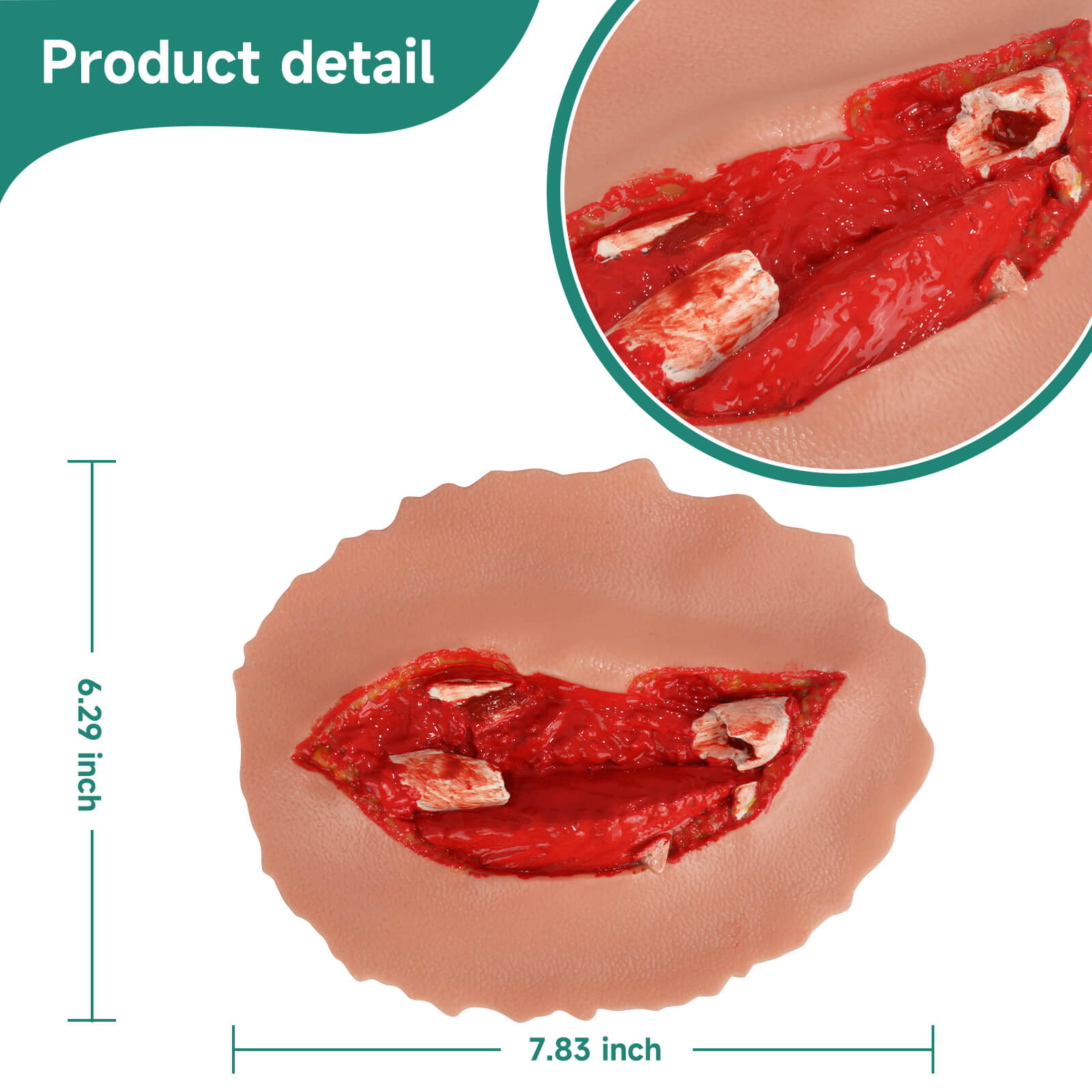 Adhensive Open Fracture Wound Moulage Grade 5 Size