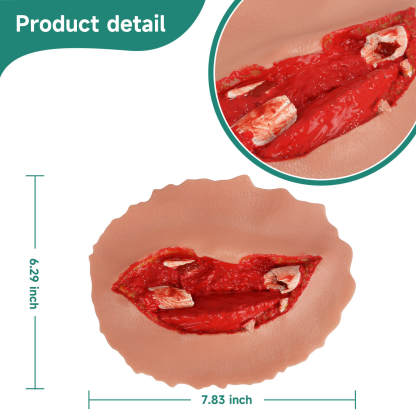Adhensive Open Fracture Wound Moulage Grade 5 Size