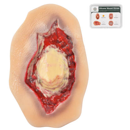 Self-Adhesive Ankle Fracture Wound Model