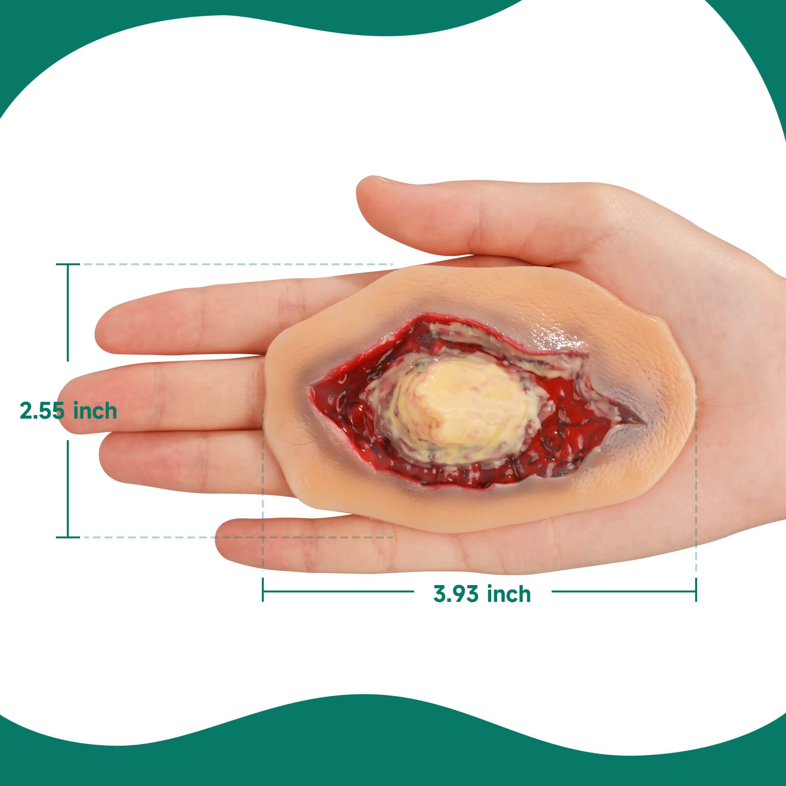 Self-Adhesive Ankle Fracture Wound Model