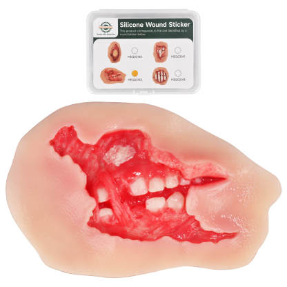 Adhesive Exposed Denture Avulsion Simulator