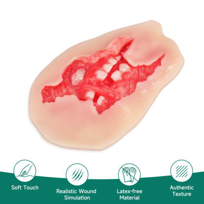 Adhesive Exposed Denture Avulsion Simulator