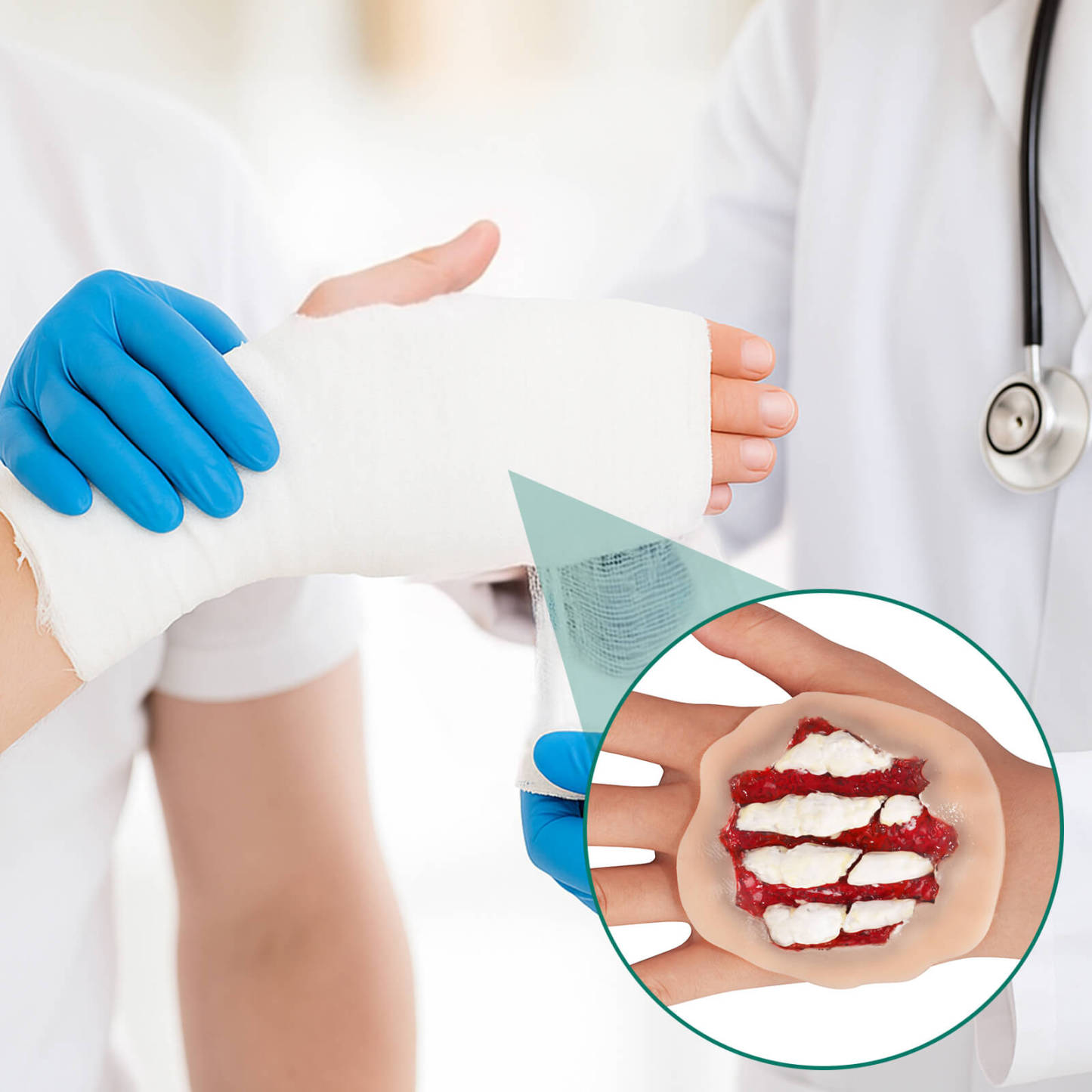 Adhesive Hand Trauma Wound Trainer