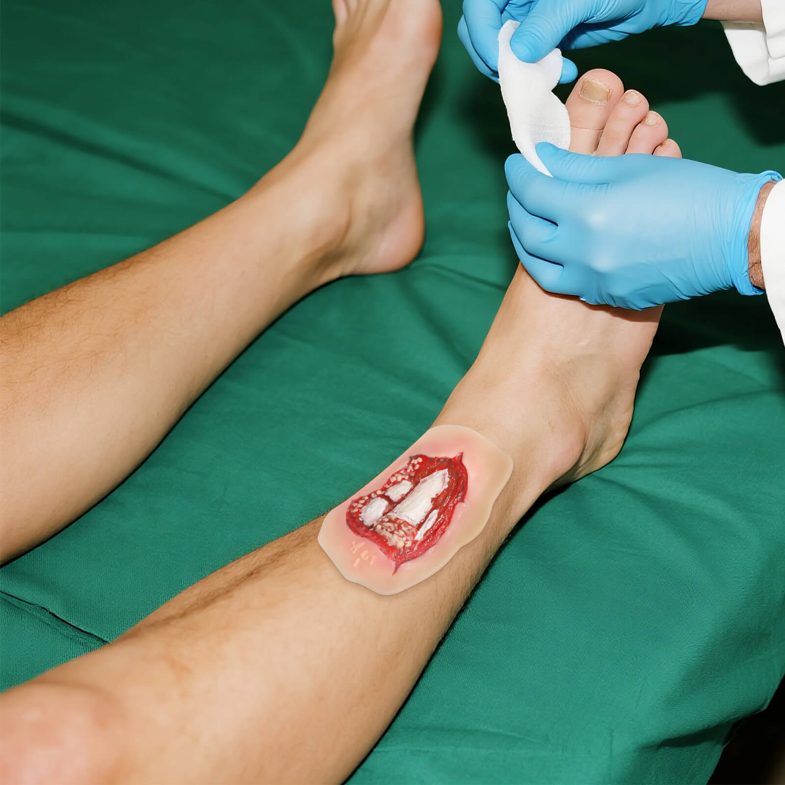 Adhesive Open Leg Fracture Wound Model