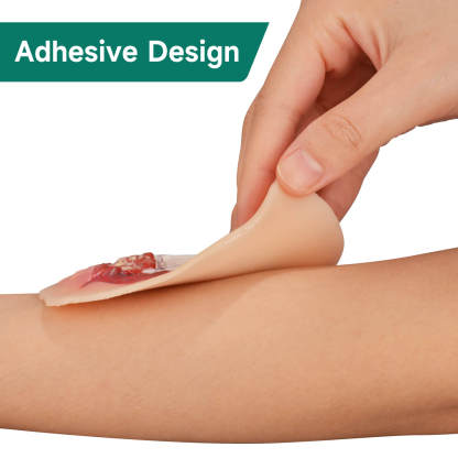 Adhesive Open Leg Fracture Wound Model
