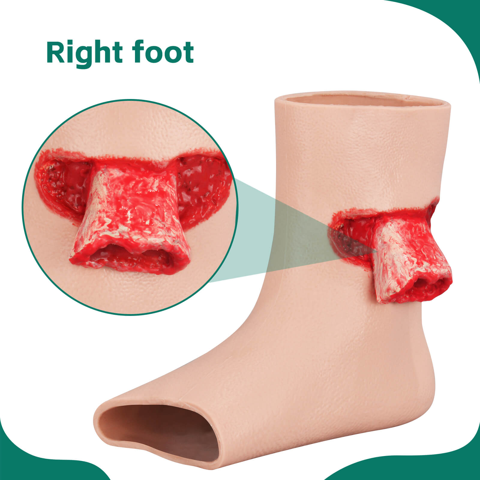 Ankle Exposed Bone Open Fracture Trainer