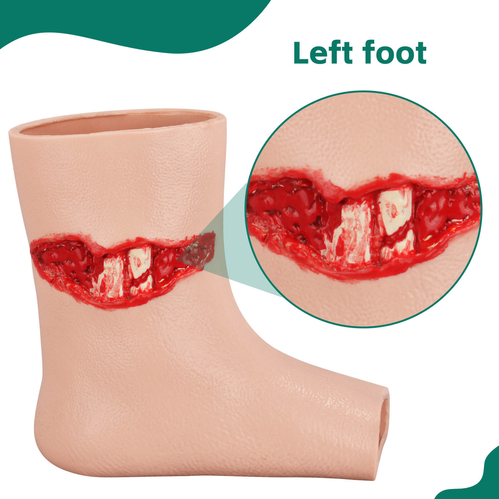 Ankle Exposed Bone Open Fracture Trainer