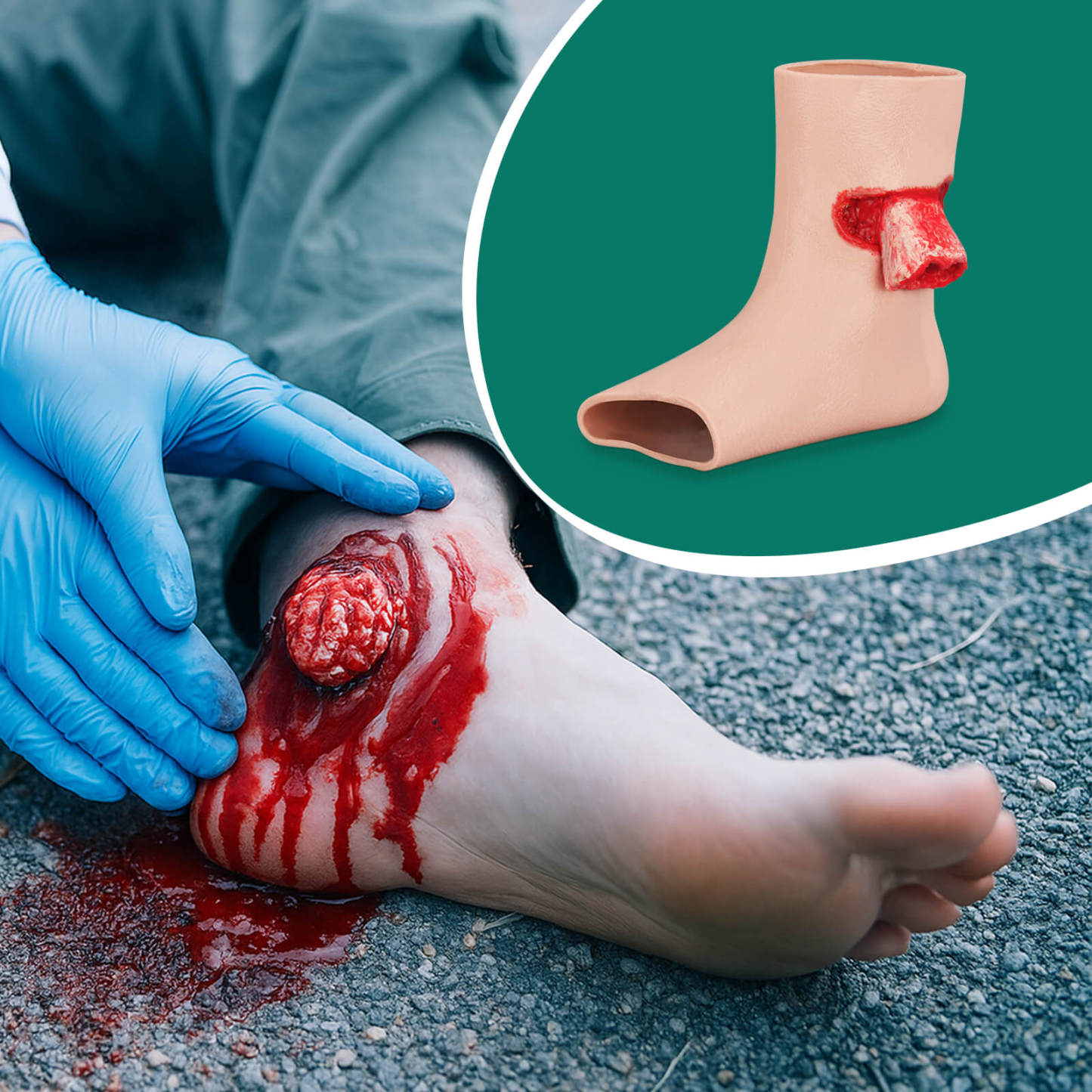 Ankle Exposed Bone Open Fracture Trainer