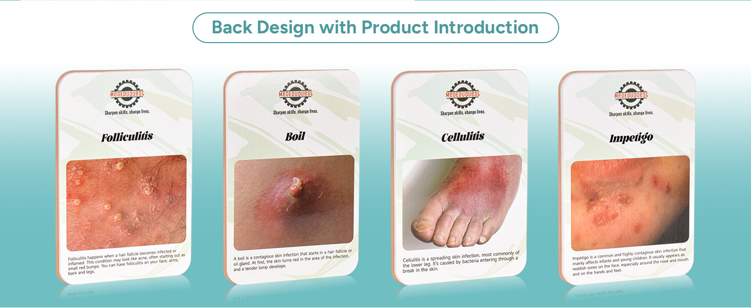 Palm Sized Bacterial Skin Infection Wound Simulation Models