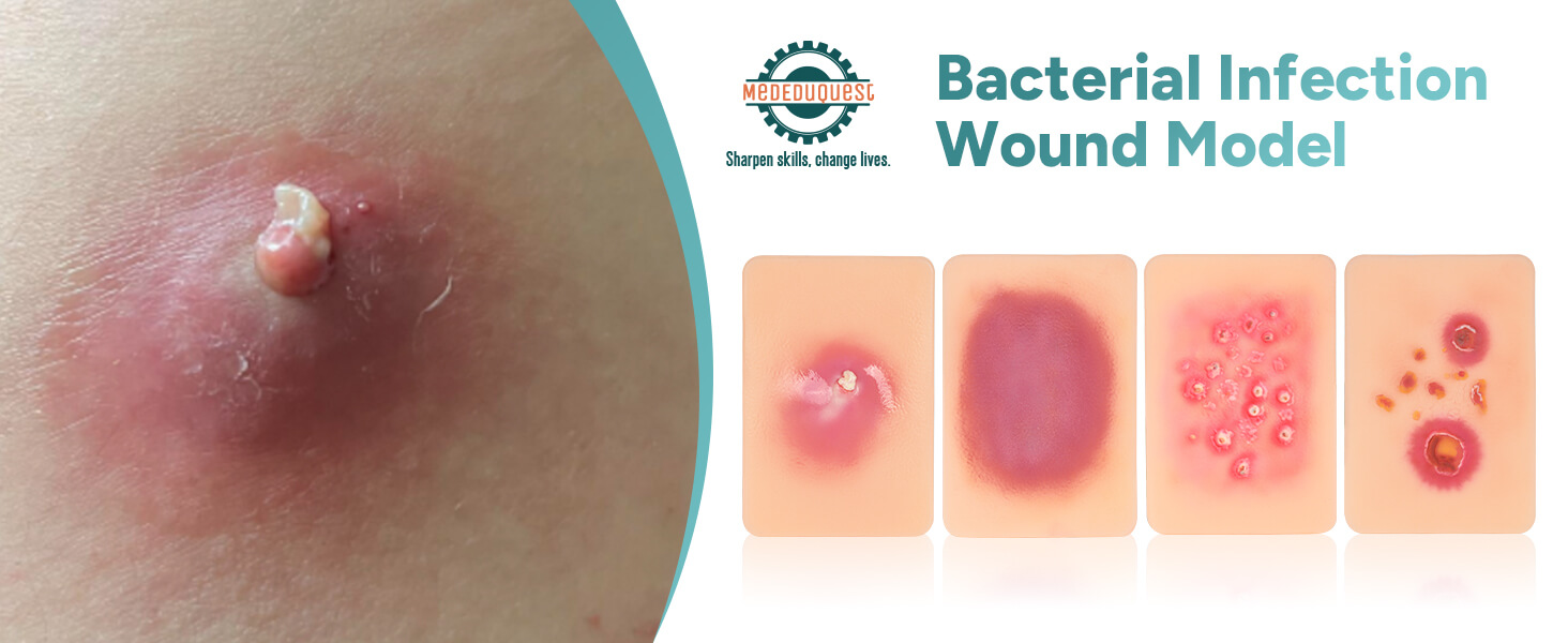 Bacterial Infected Wound Model