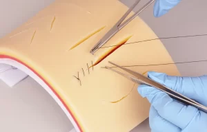 Better Material for Surgical Residents Practicing Instead of on Pig Skin