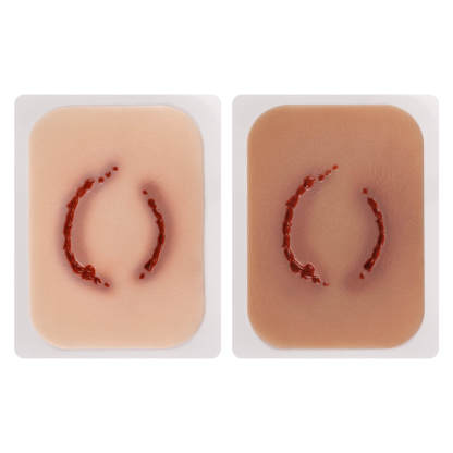 human bite wound moulage, 2 pcs