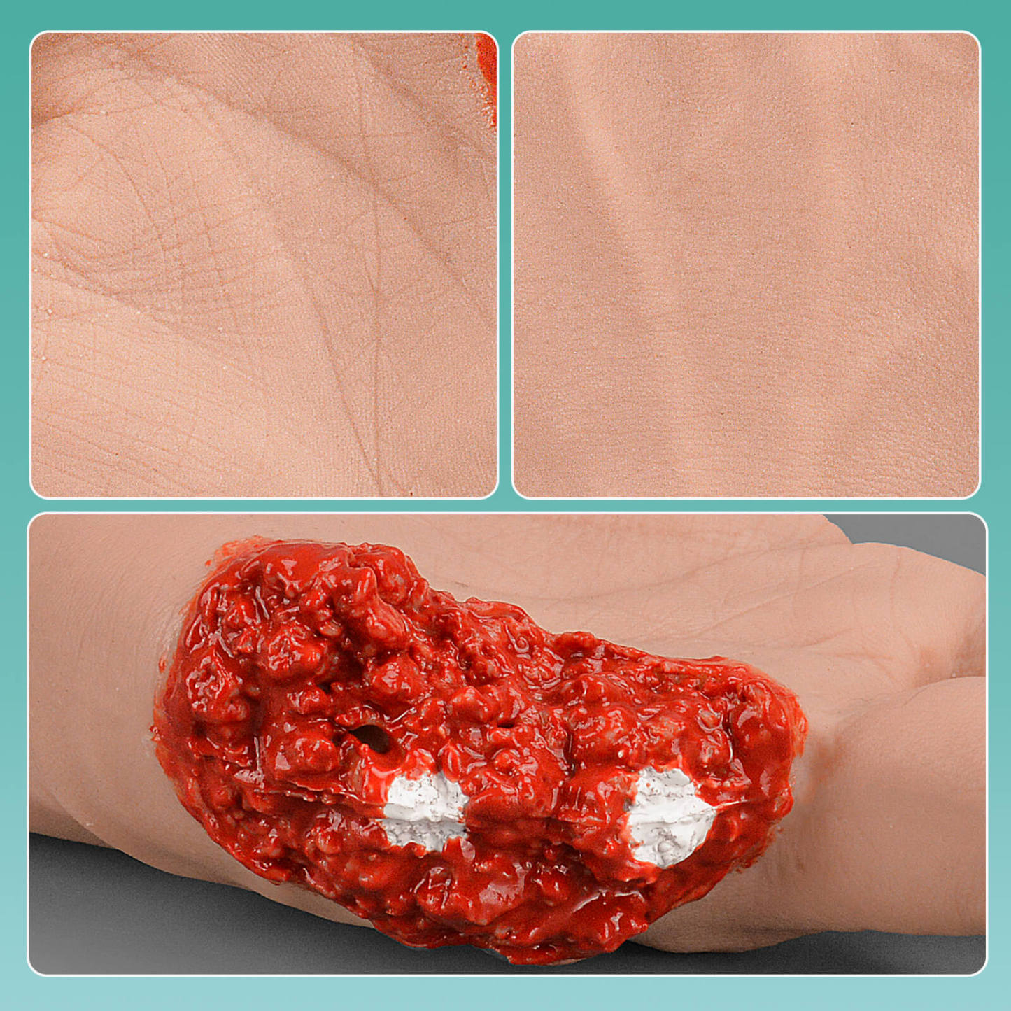 Lifelike Trauma Hand with Broken Finger Wound