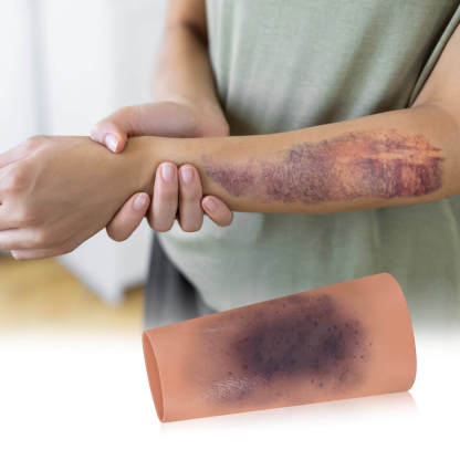 Bruise Wound Care Simulation Sleeve