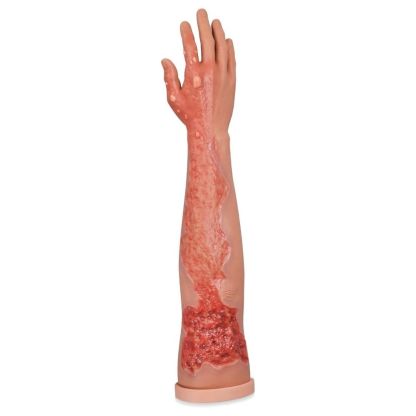 Multi-Degree Burn Wound Arm Care Task Trainer
