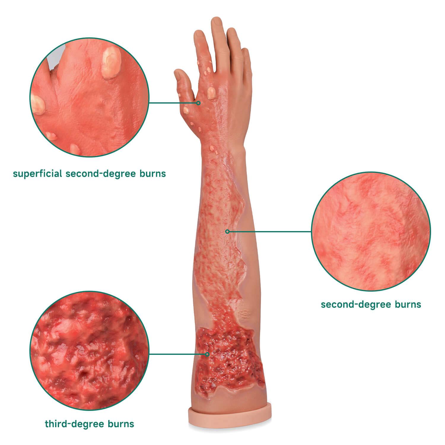 Multi-Degree Burn Wound Arm Care Task Trainer