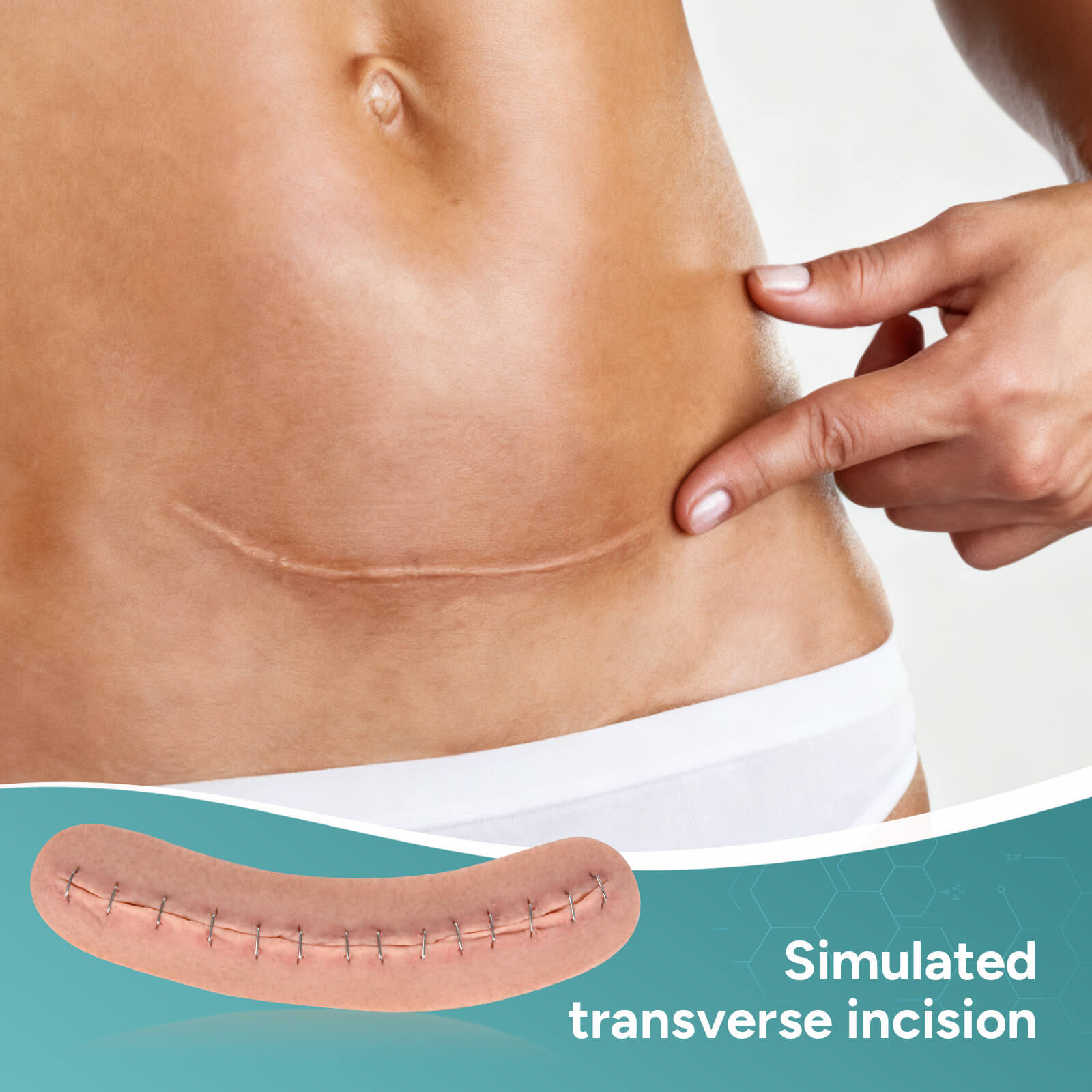 C-Section Wound Model Set with Staples