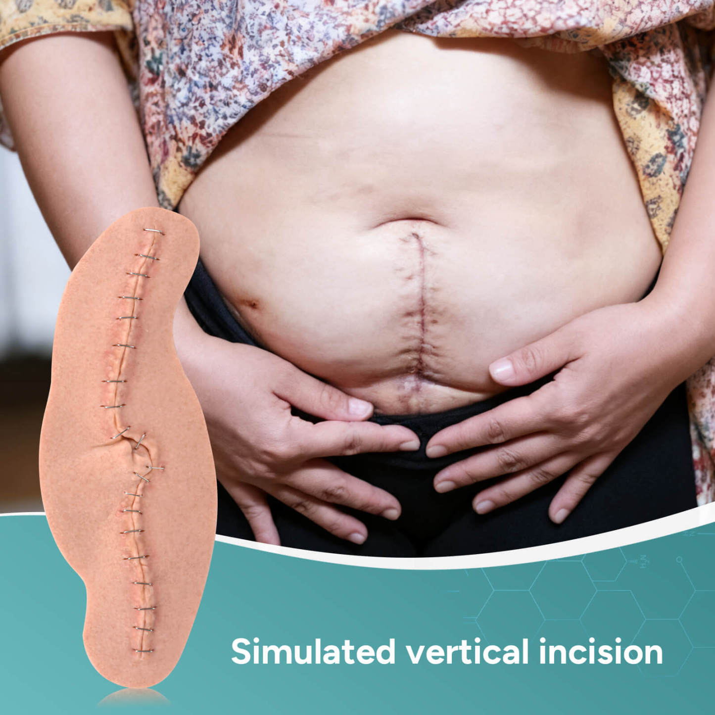 C-Section Wound Model Set with Staples