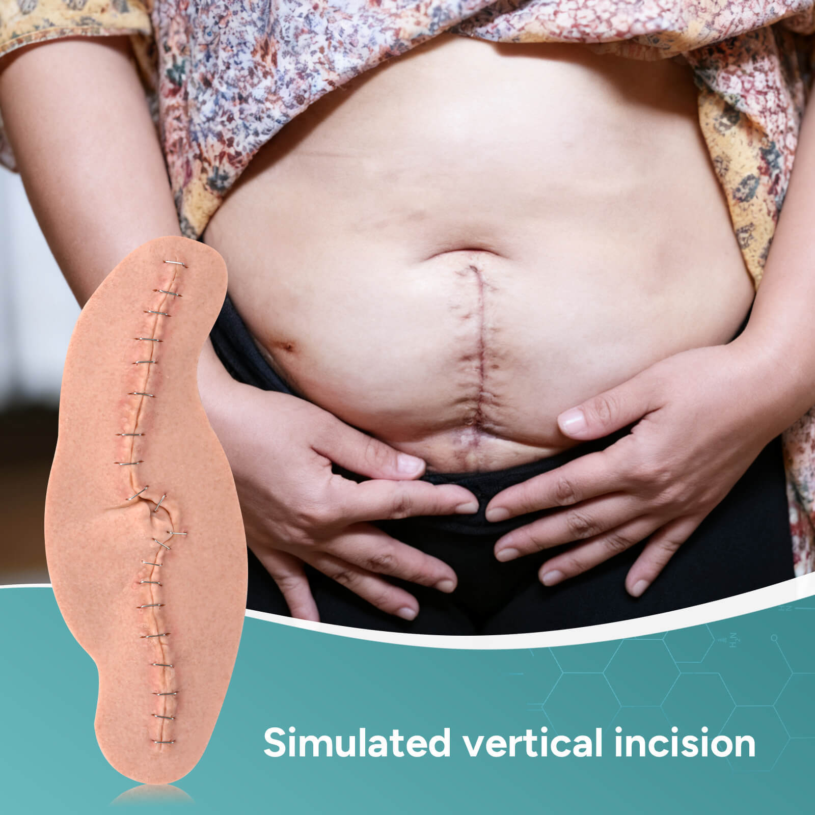 C-Section Wound Model Set with Staples