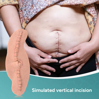 C-Section Wound Model Set with Staples