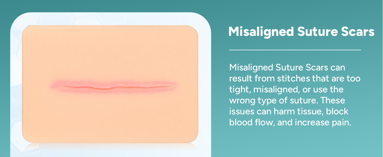 Palm-sized Atrophic Scar Wound Simulation Models (Set of 3)