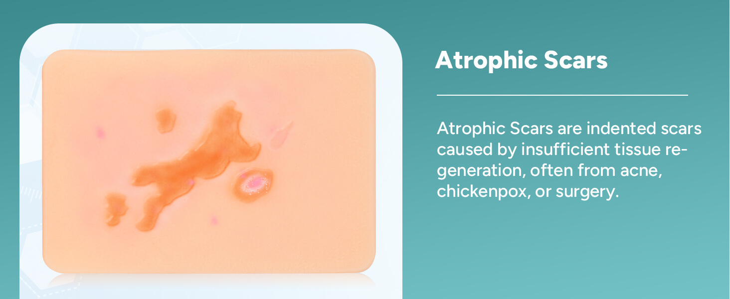 Card-sized Depressed Scar Wound Simulation Models (Set of 3)