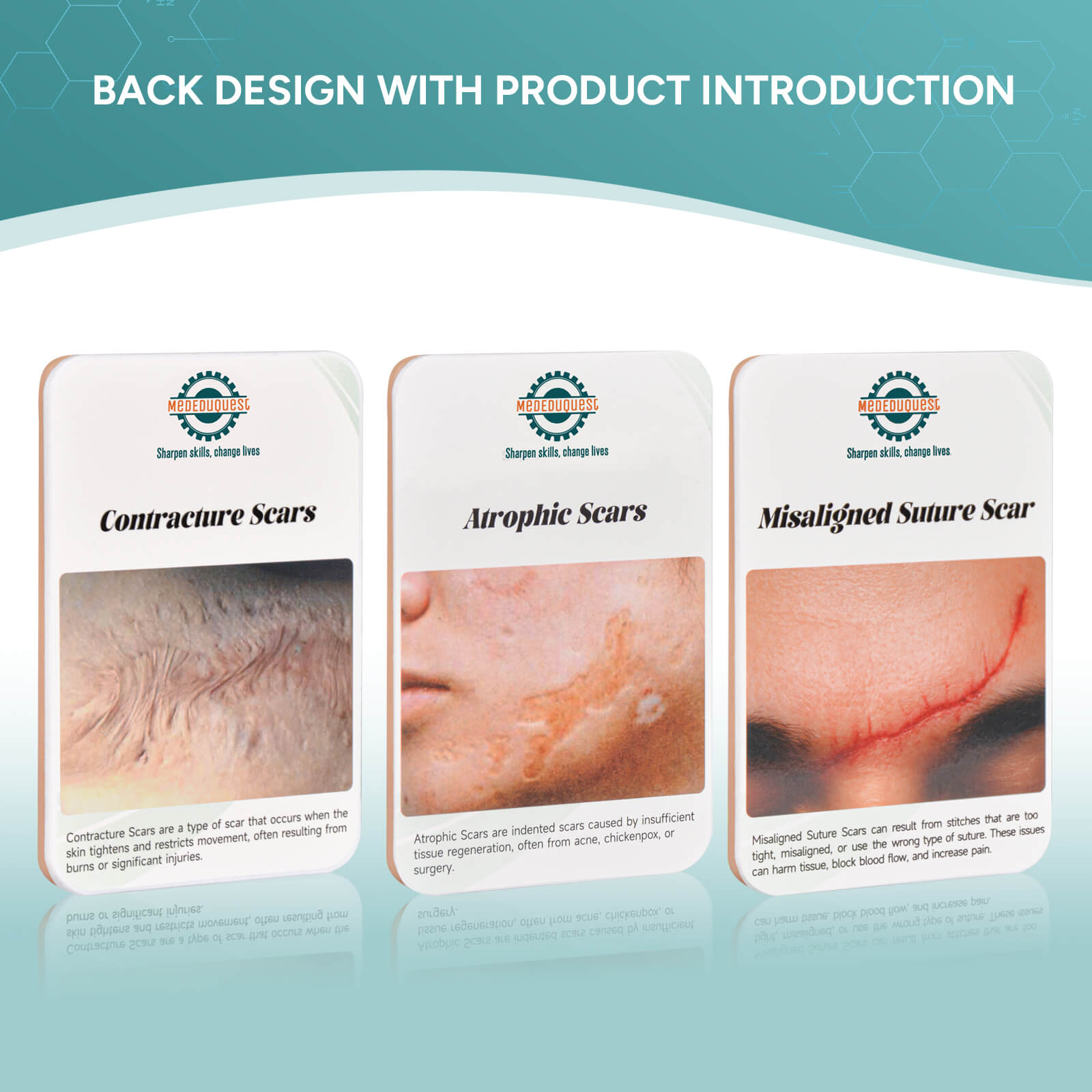 Card-sized Atrophic Scar Wound Simulation Models (Set of 3)