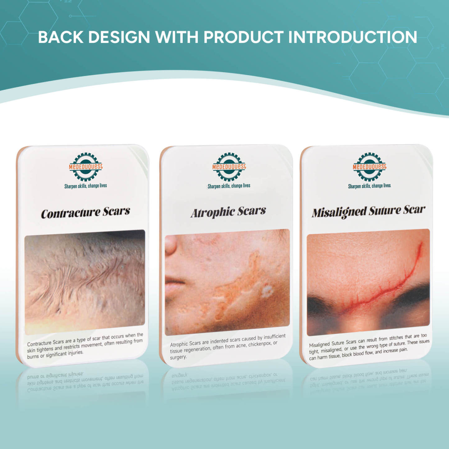 Card-sized Atrophic Scar Wound Simulation Models (Set of 3)