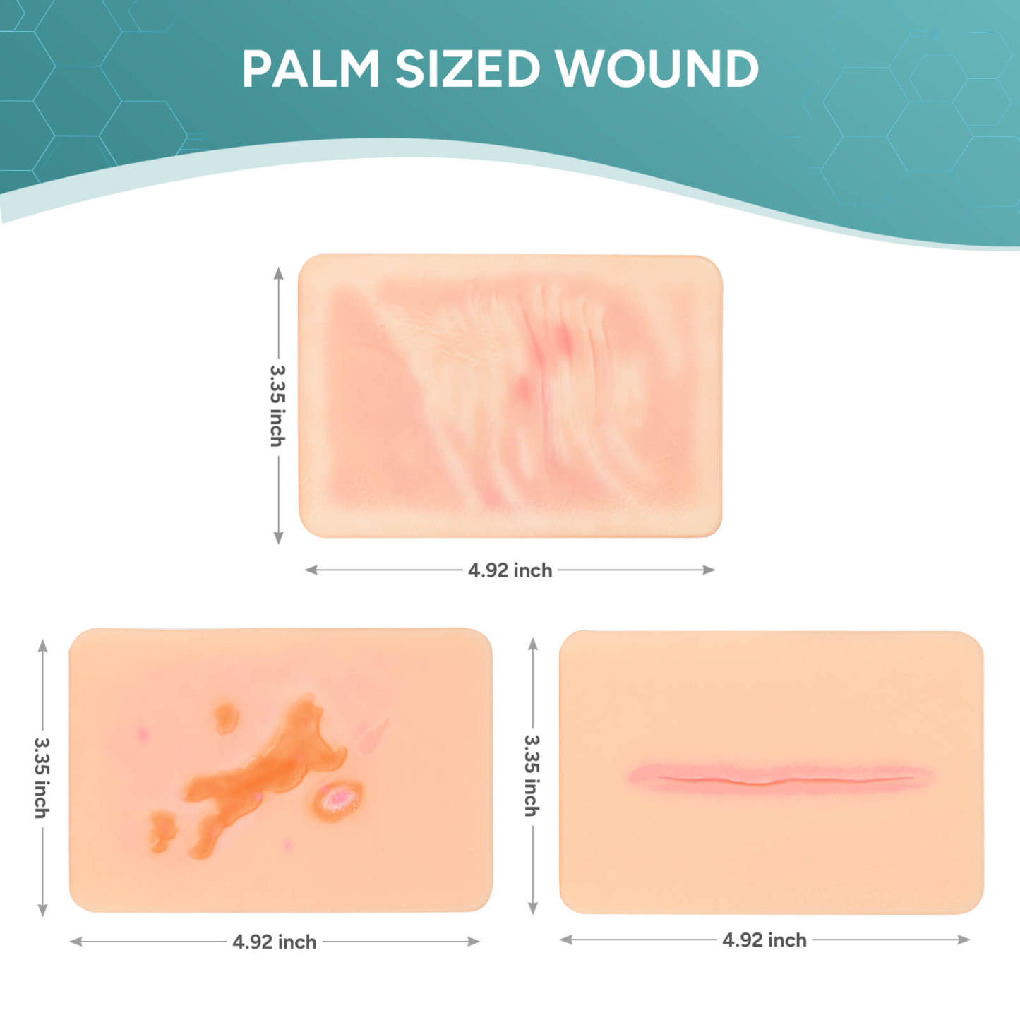 Card-sized Atrophic Scar Wound Simulation Models (Set of 3)