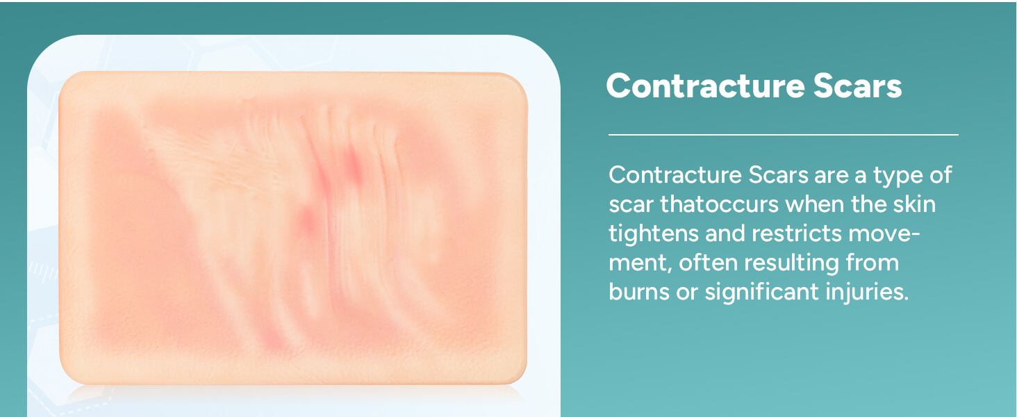 Card-sized Atrophic Scar Wound Simulation Models (Set of 3)