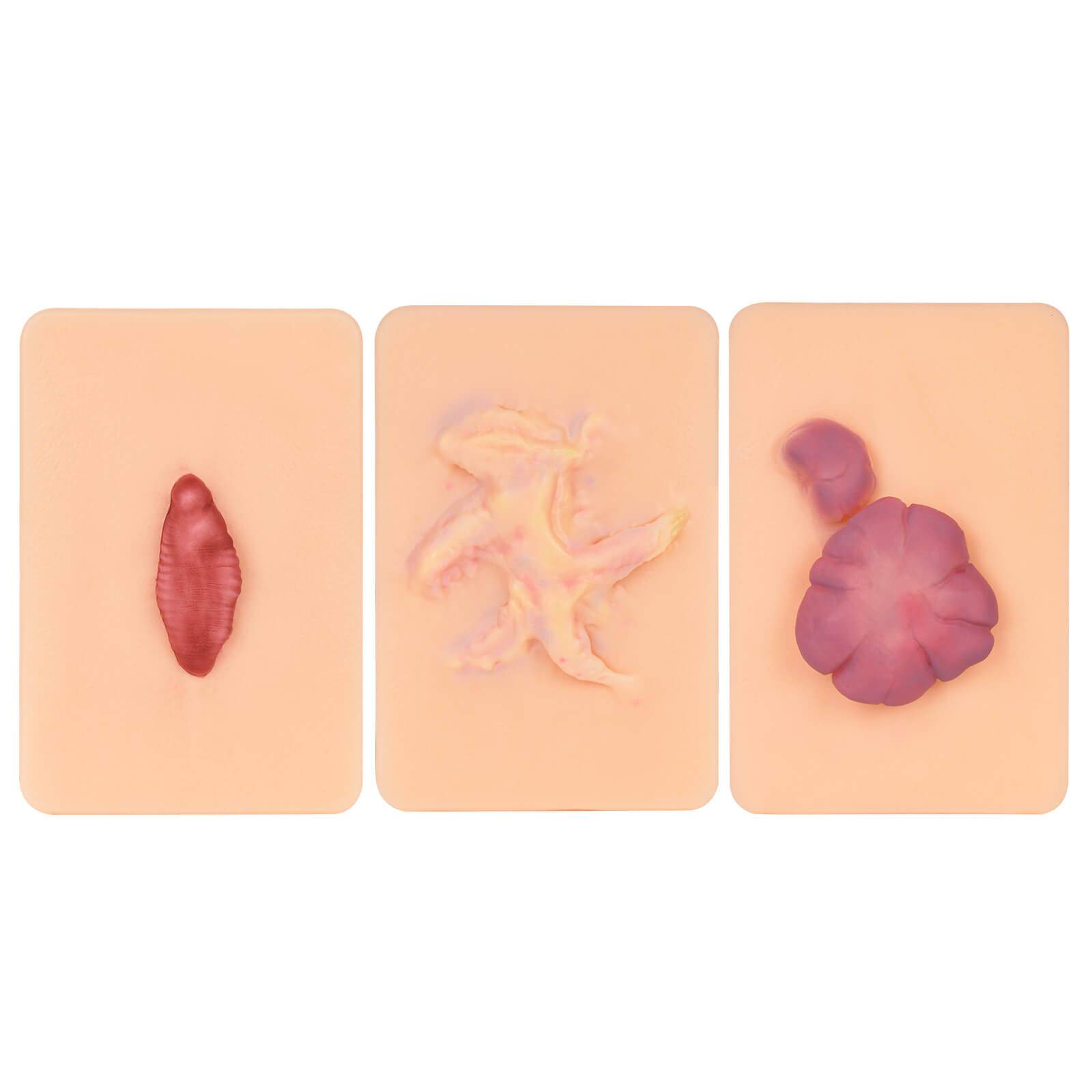 Card-sized Hypertrophic Scar Wound Simulation Models (Set of 3)