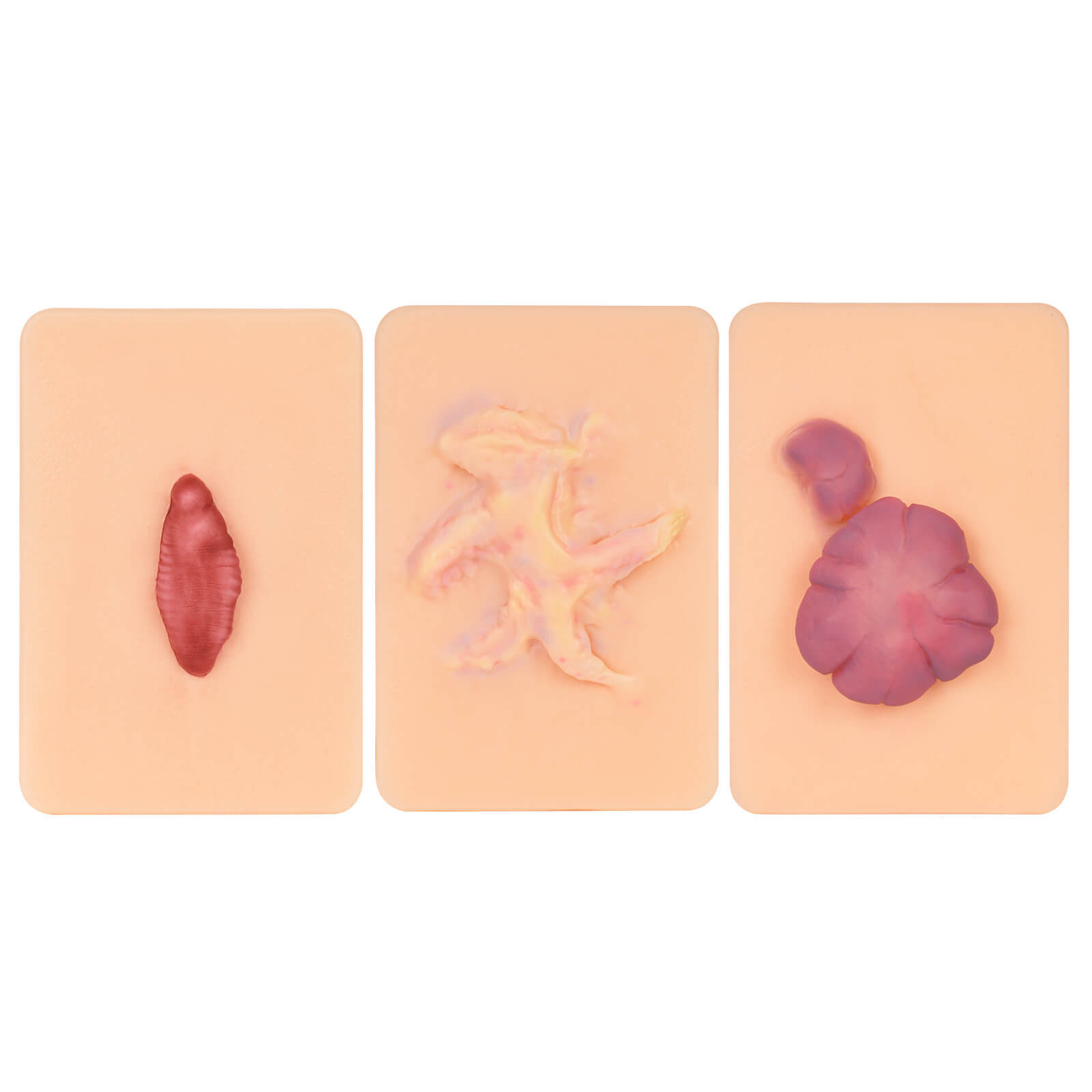 Card-sized Hypertrophic Scar Wound Simulation Models (Set of 3)
