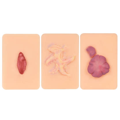 Card-sized Hypertrophic Scar Wound Simulation Models (Set of 3)
