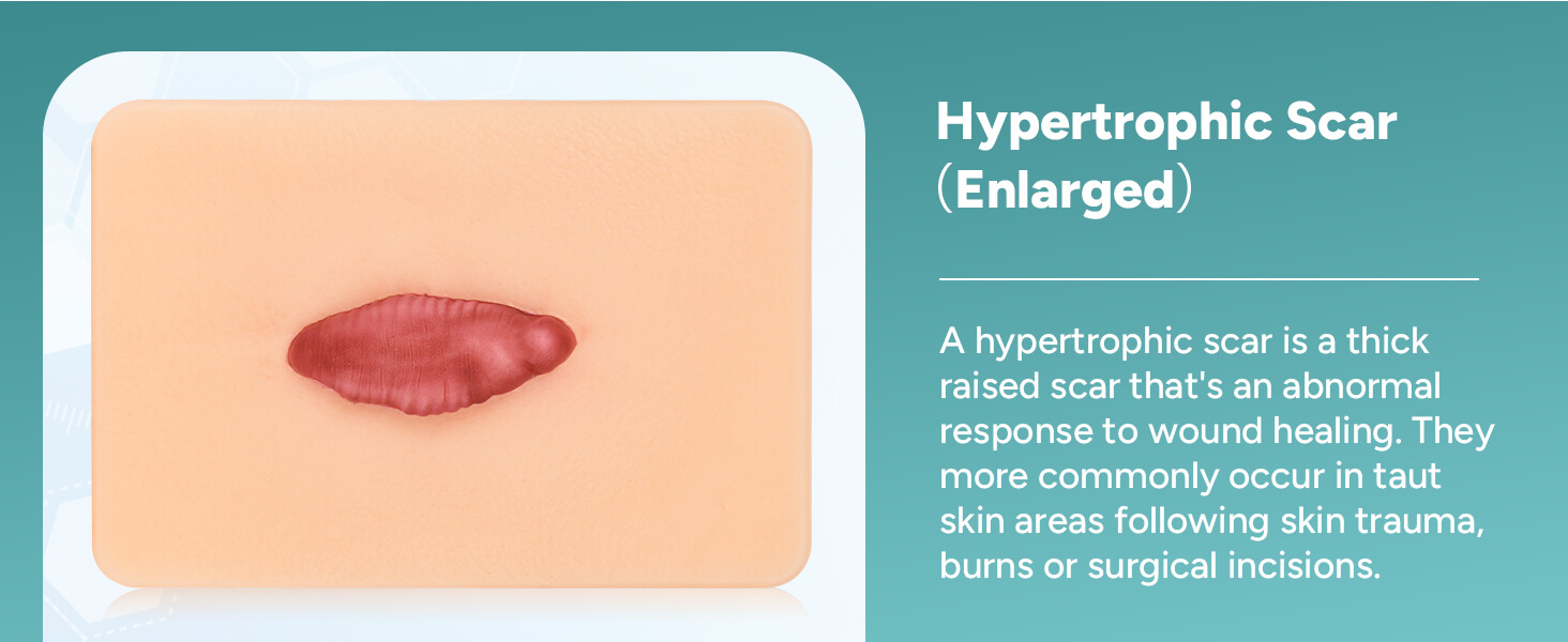 Card-sized Hypertrophic Scar Wound Simulation Models (Set of 3)