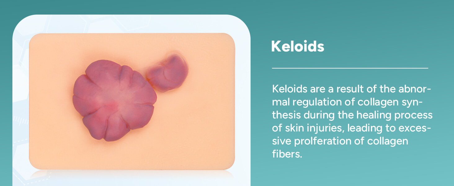 Card-sized Hypertrophic Scar Wound Simulation Models (Set of 3)