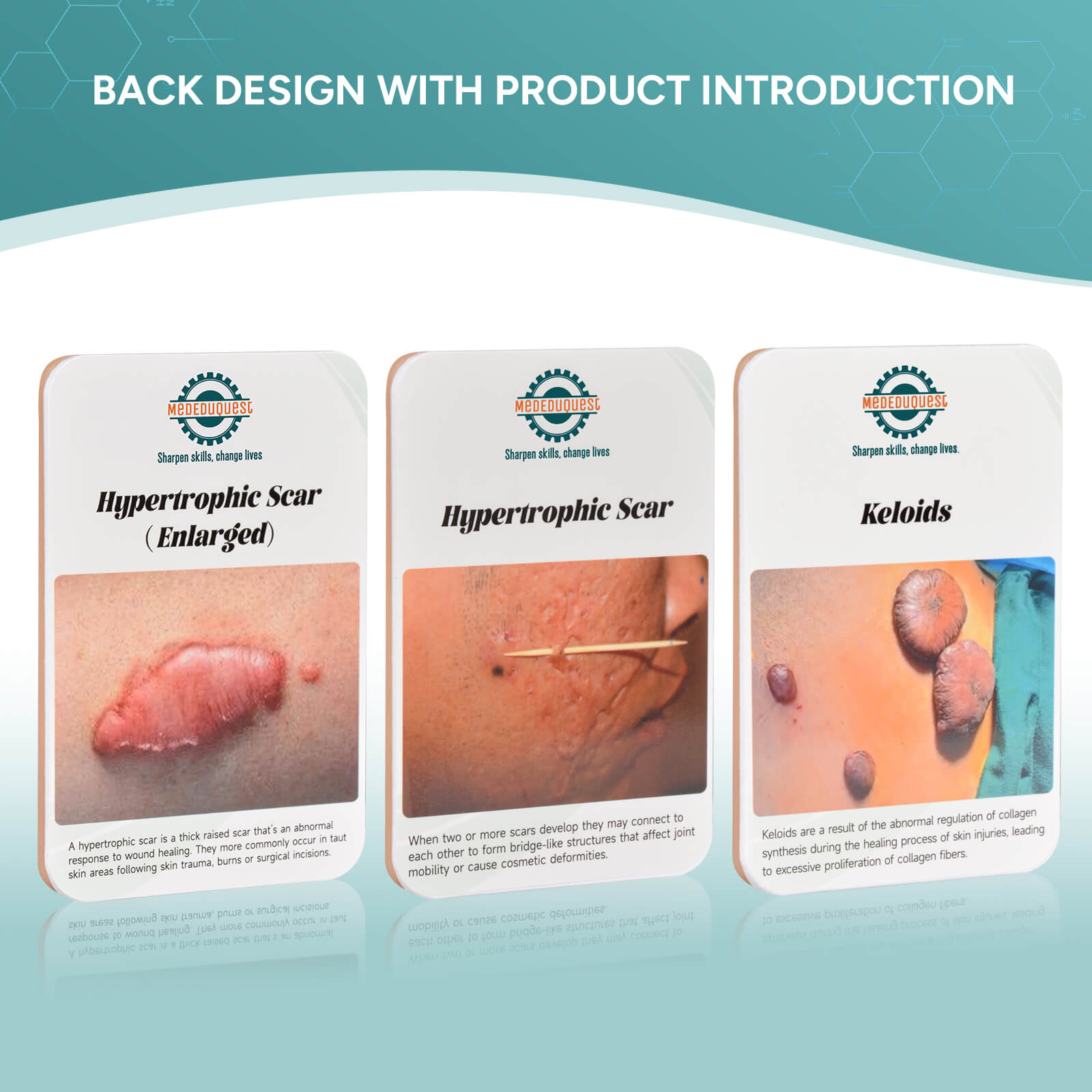 Card-sized Hypertrophic Scar Wound Simulation Models (Set of 3)