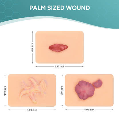 Card-sized Hypertrophic Scar Wound Simulation Models (Set of 3)