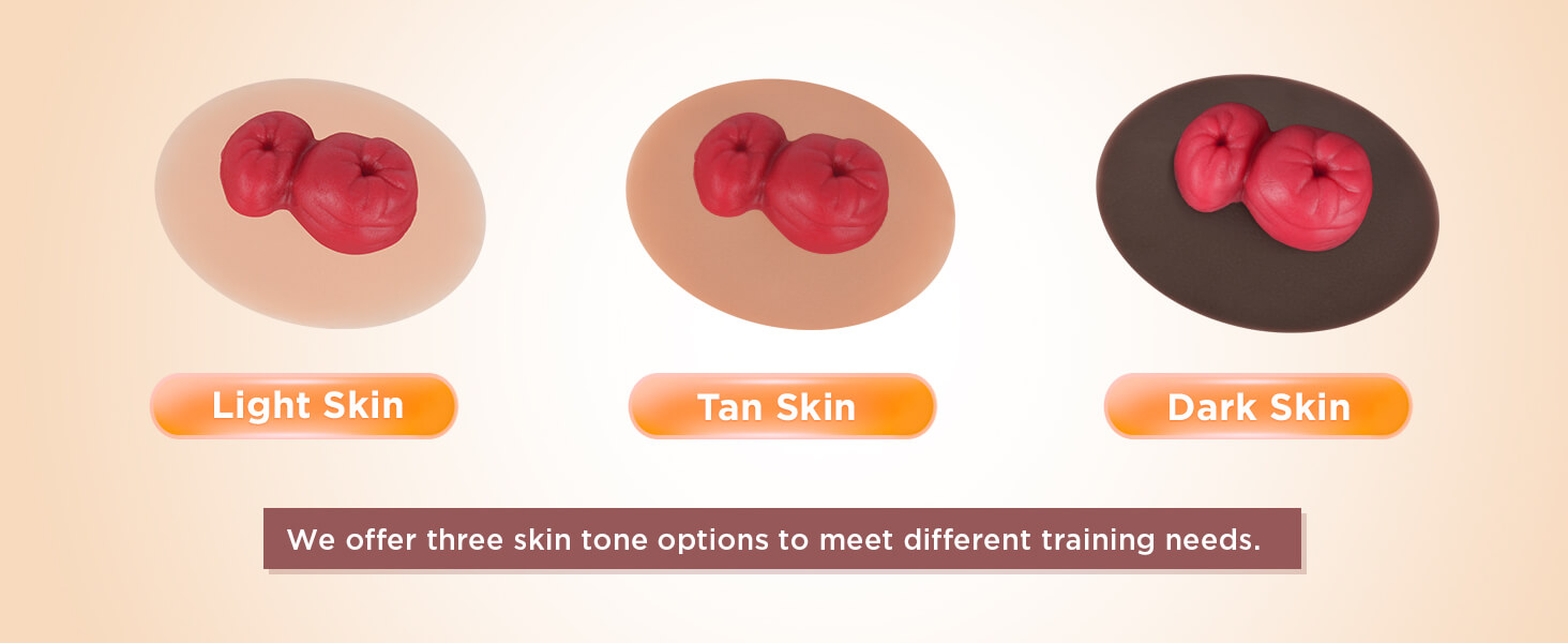 Sticky Loop Ileostomy Simulators, Multi-Skin Tone