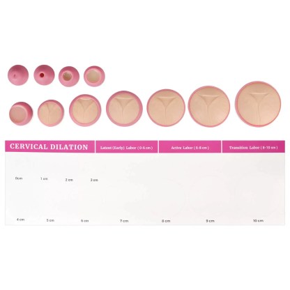Cervical Dilation Model Set 0-10cm (11 Models) with Scroll Display