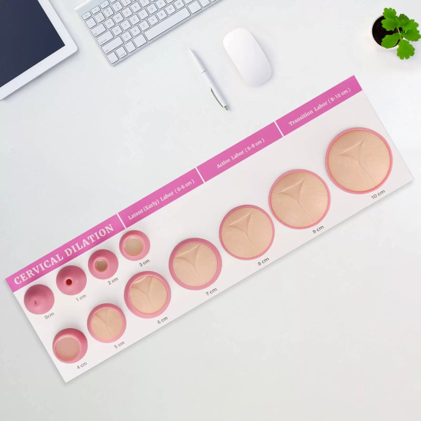 Cervical Dilation Model Set 0-10cm (11 Models) for Midwife and Doula Training