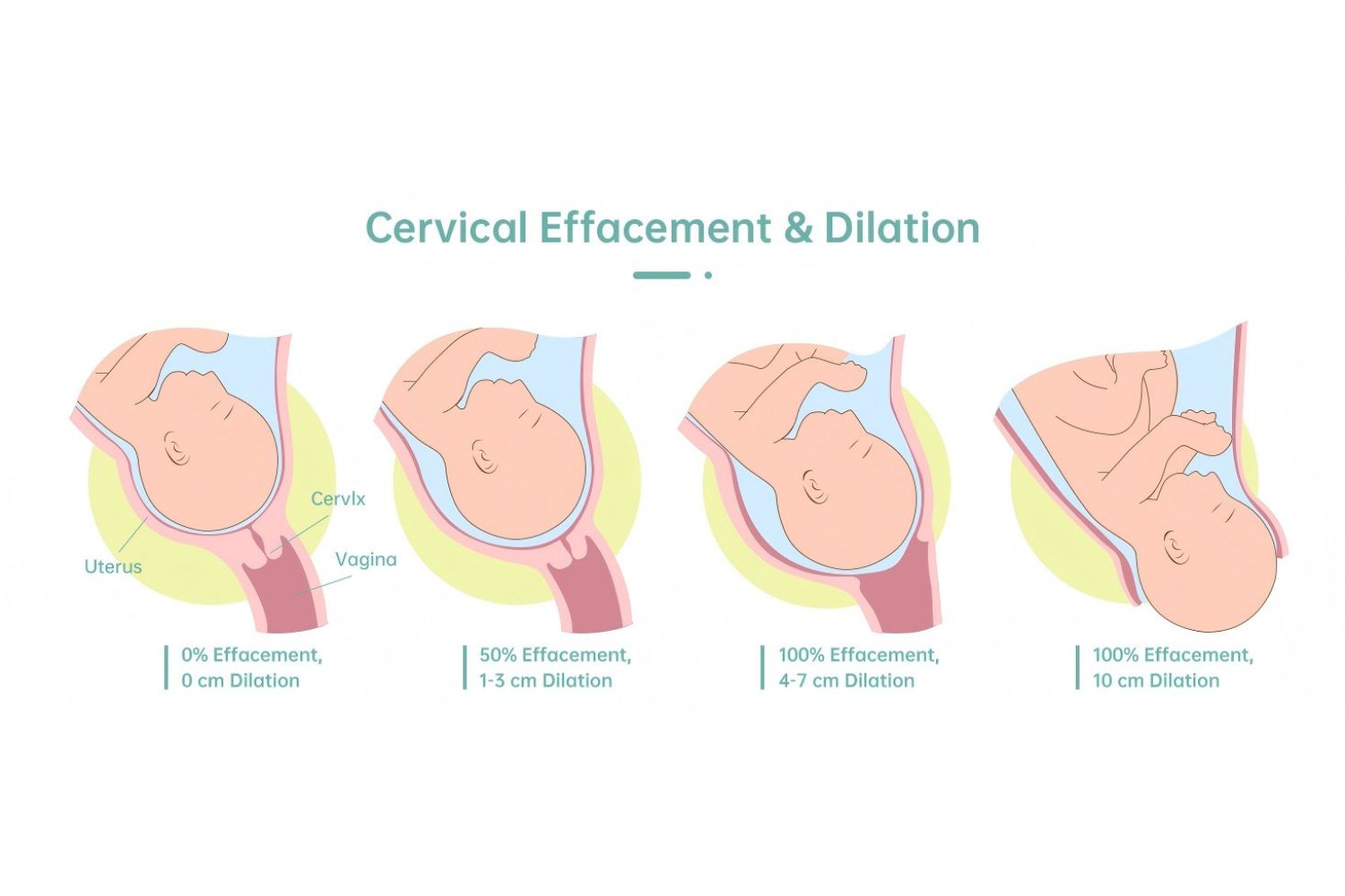 Cervical Dilation vs. Effacement: Understanding the Difference