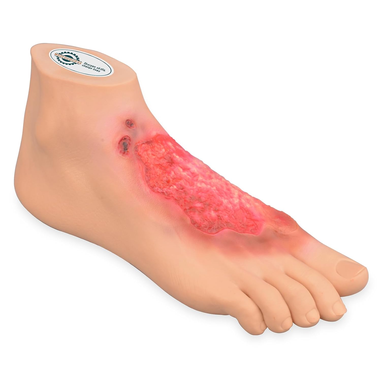 Chemical Burn Foot Demonstration Model